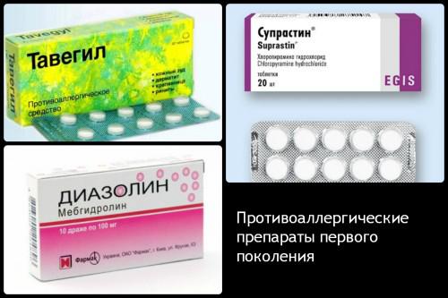 антигистаминные препараты в таблетках